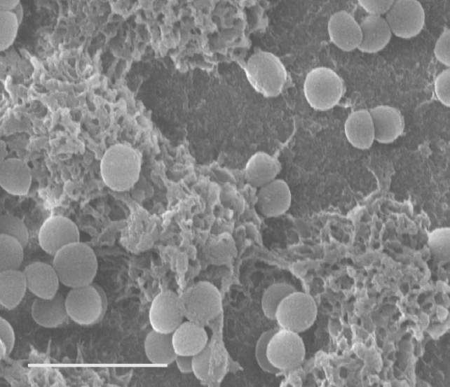 Cryo-SEM image of S. aureus biofilm
